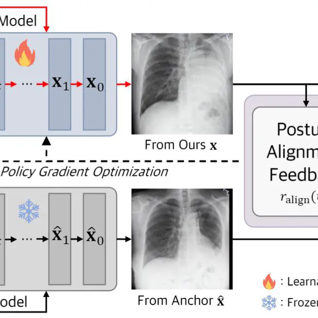 Advancing Text-Driven Chest X-Ray Generation with Policy-Based Reinforcement Learning