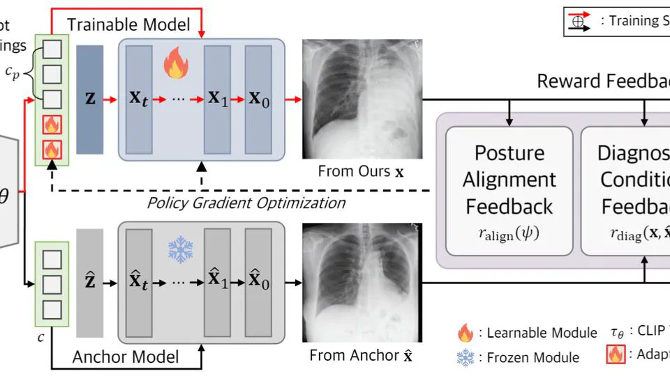 Advancing Text-Driven Chest X-Ray Generation with Policy-Based Reinforcement Learning